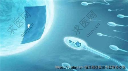 浙江现在做三代试管多少钱