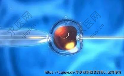 萍乡哪里做试管婴儿比较便宜
