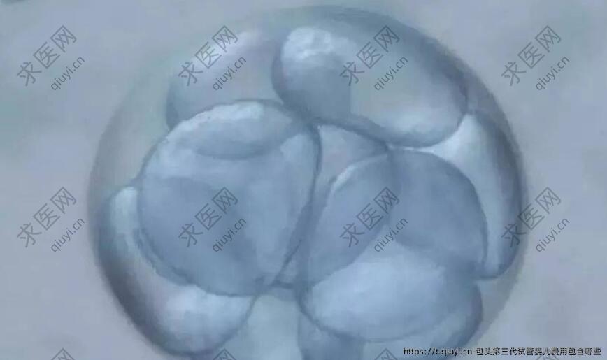 包头第三代试管婴儿费用包含哪些