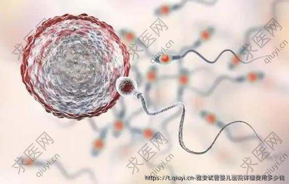 雅安试管婴儿医院详细费用多少钱