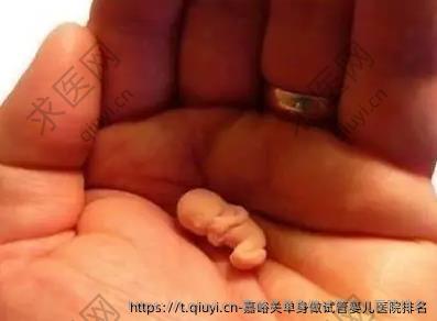 嘉峪关单身做试管婴儿医院排名