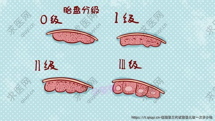 信阳第三代试管婴儿做一次多少钱