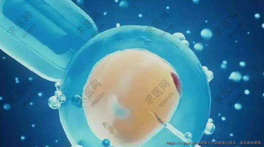汕尾第三代试管婴儿技术、成功率和费用