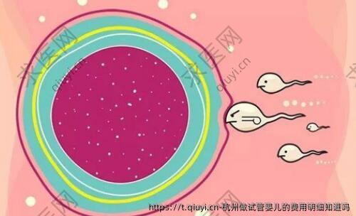 杭州做试管婴儿的费用明细知道吗