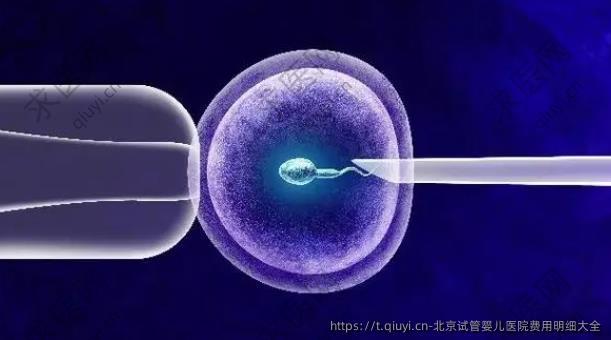 北京试管婴儿医院费用明细大全
