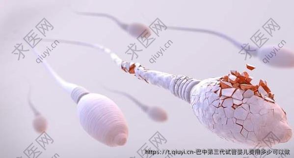 巴中第三代试管婴儿费用多少可以做