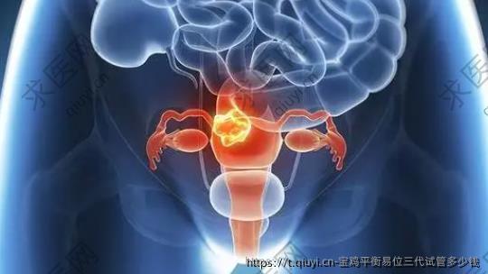 宝鸡平衡易位三代试管多少钱