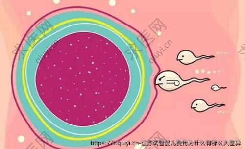 江苏试管婴儿费用为什么有那么大差异