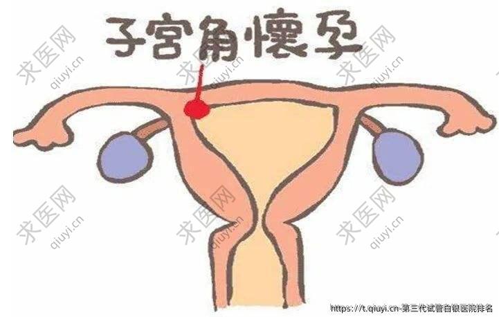 第三代试管白银医院排名