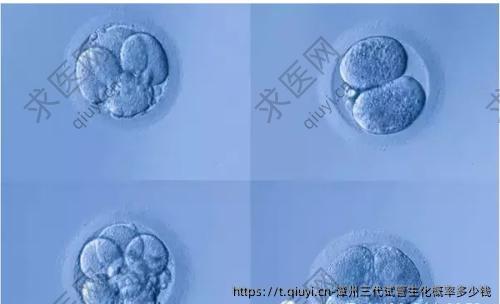 漳州三代试管生化概率多少钱