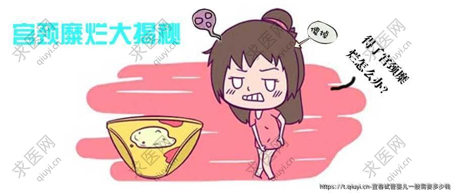 宜春试管婴儿一般需要多少钱