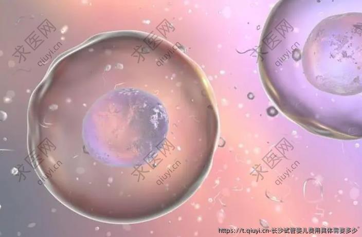 长沙试管婴儿费用具体需要多少