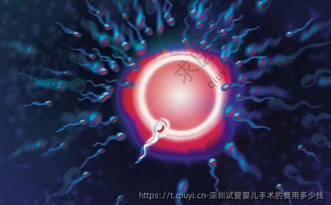 深圳试管婴儿手术的费用多少钱