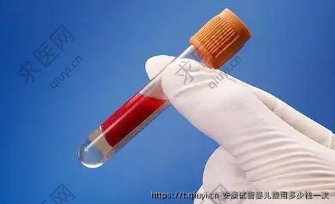 安康试管婴儿费用多少钱一次