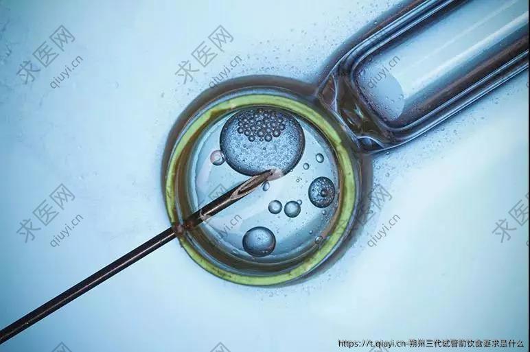 朔州三代试管前饮食要求是什么