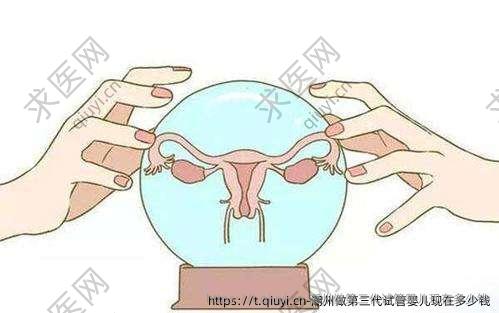 潮州做第三代试管婴儿现在多少钱