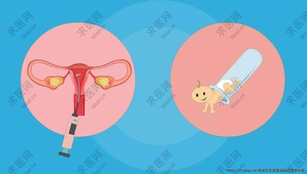 株洲三代试管高龄过筛多少钱