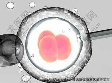 景德镇做第三代试管宝宝