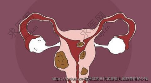 福州做第三代试管婴儿医院费用多少钱