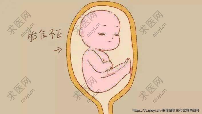 玉溪做第三代试管的条件