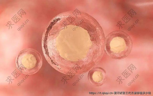 漯河试管三代方案移植多少钱