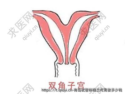 青岛试管移植三代需要多少钱