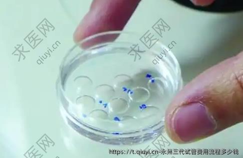 永州三代试管费用流程多少钱