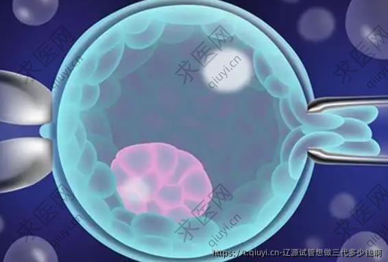 辽源试管想做三代多少钱啊