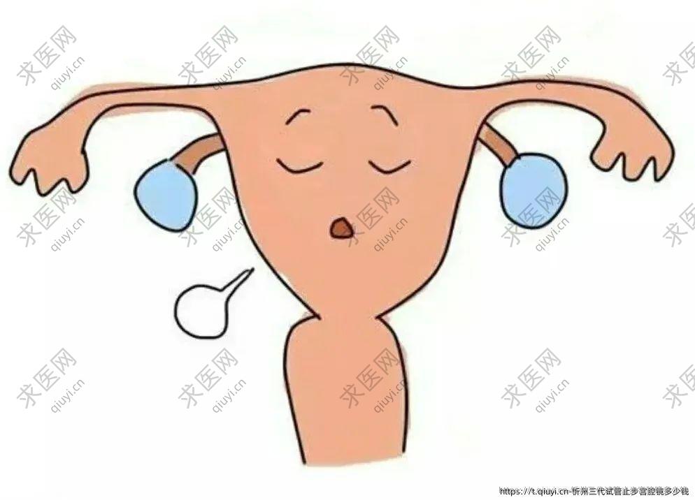 忻州三代试管止步宫腔镜多少钱