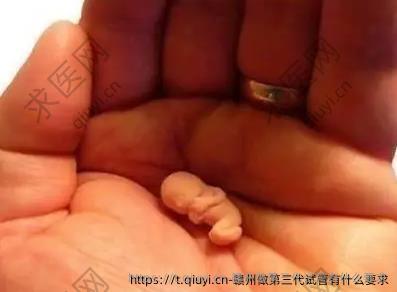 赣州做第三代试管有什么要求