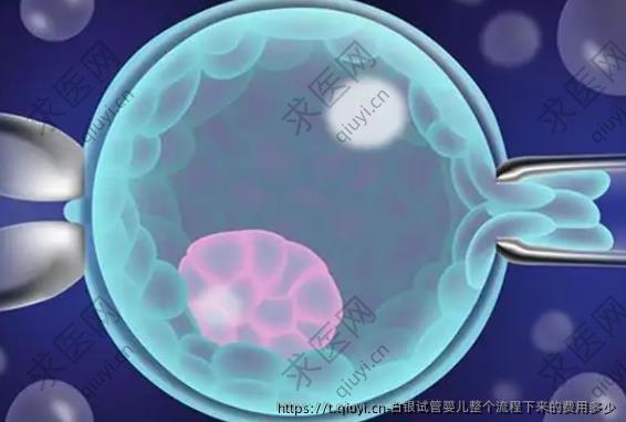 白银试管婴儿整个流程下来的费用多少