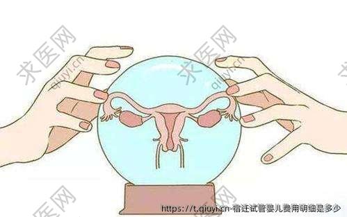 宿迁试管婴儿费用明细是多少