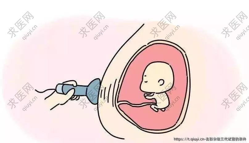 去新余做三代试管的条件
