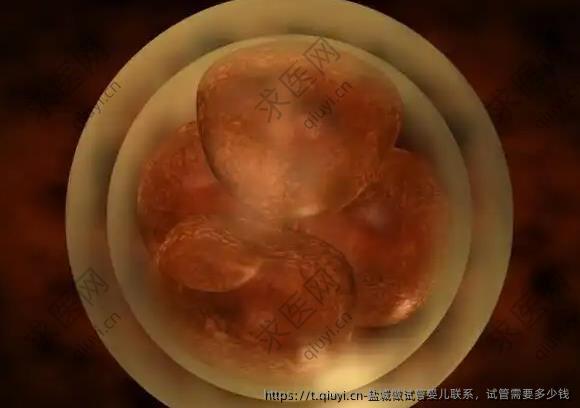 盐城做试管婴儿联系，试管需要多少钱