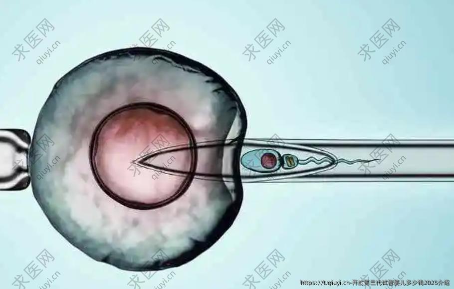 开封第三代试管婴儿多少钱2025介绍