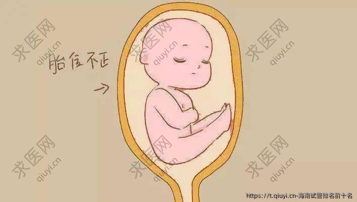 海南试管排名前十名