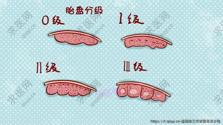 益阳做三代试管花多少钱