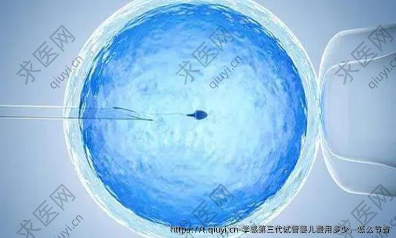 孝感第三代试管婴儿费用多少，怎么节省