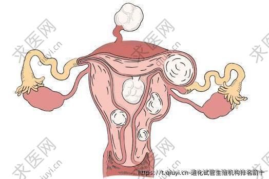 通化试管生殖机构排名前十