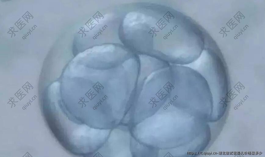 湖北做试管婴儿价格是多少