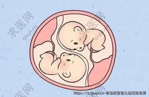 青海试管婴儿医院排名需