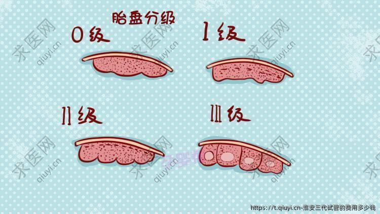 淮安三代试管的费用多少钱