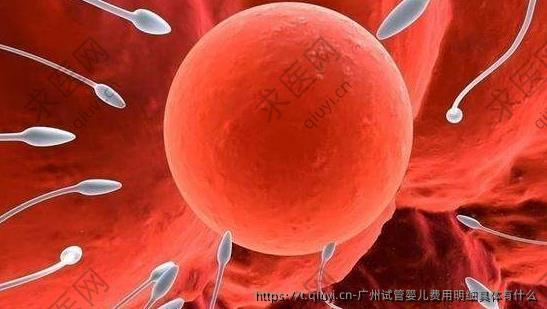 广州试管婴儿费用明细具体有什么
