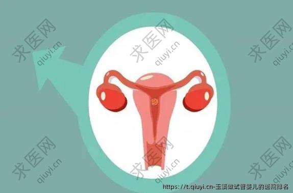 玉溪做试管婴儿的医院排名