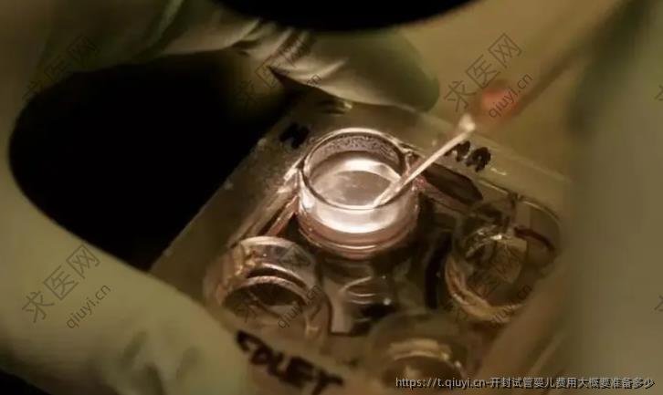 开封试管婴儿费用大概要准备多少