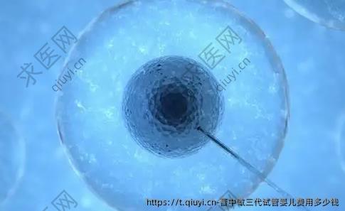 晋中做三代试管婴儿费用多少钱