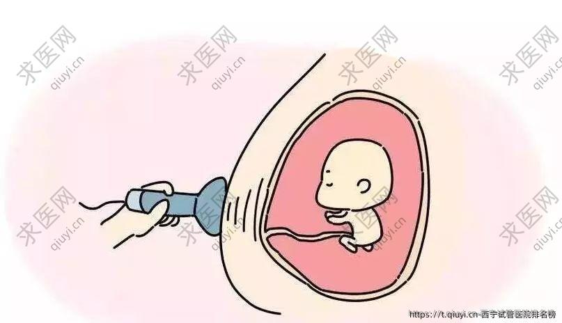 西宁试管医院排名榜