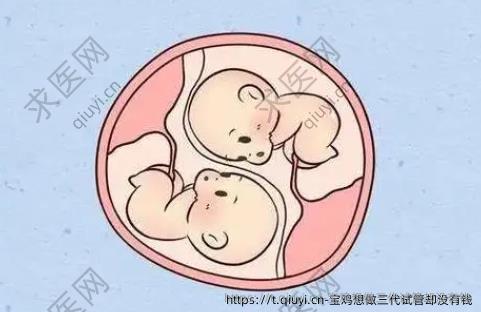 宝鸡想做三代试管却没有钱