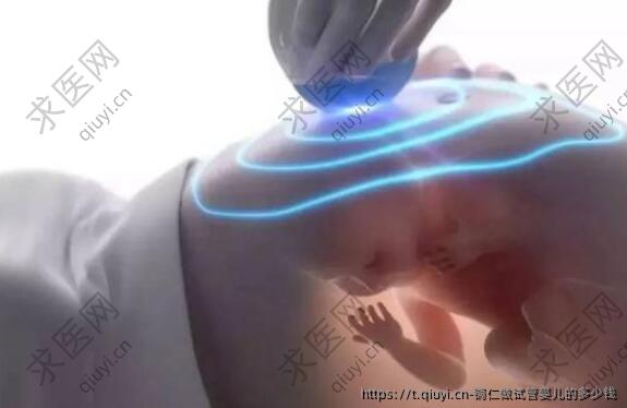 铜仁做试管婴儿的多少钱
