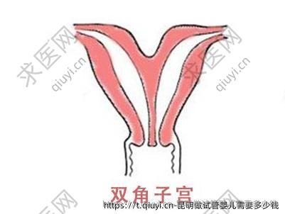 昆明做试管婴儿需要多少钱